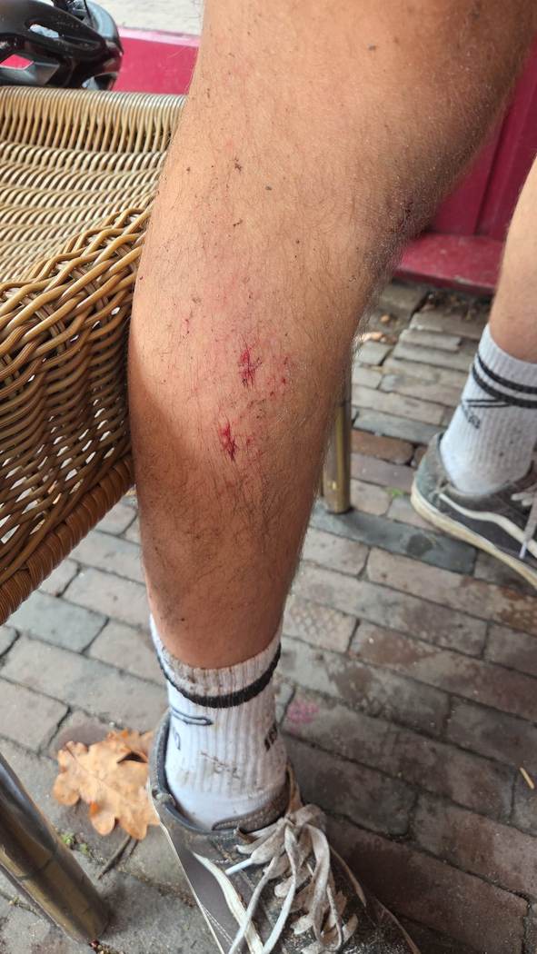 Oorlogswond — gevallen in de eerste bocht, gewoon doorgereden